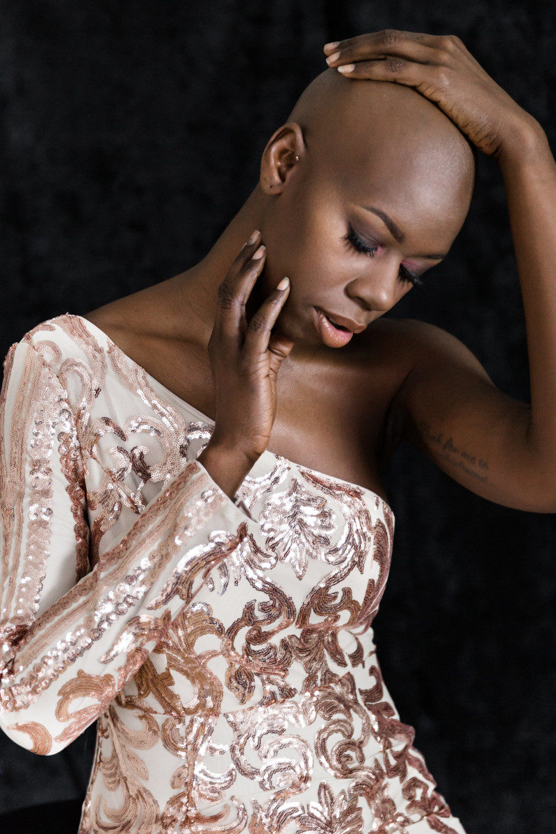 How Losing My Hair Boosted My Self-Confidence